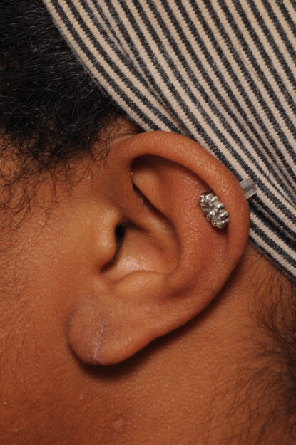 bna-sample